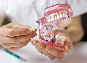 Hands holding sample implant bridge and model jaw