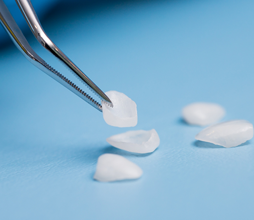 Picking up veneers in West Palm Beach