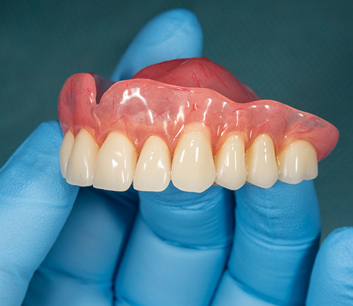 Gloved hand holding a full denture